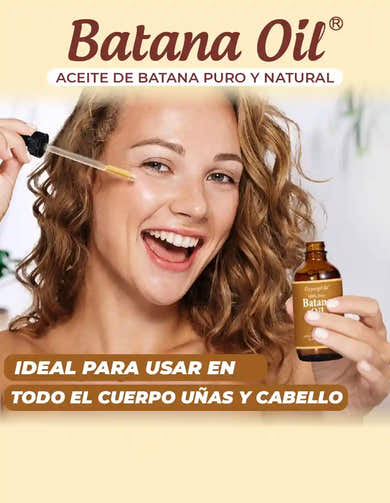 Imagen del carrusel