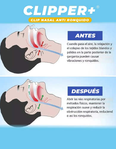 Imagen del carrusel