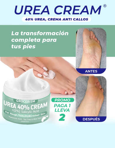 Imagen del carrusel