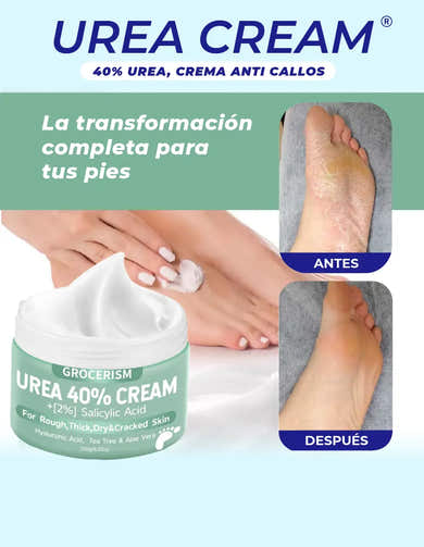 Imagen del carrusel