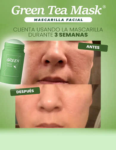 Imagen del carrusel
