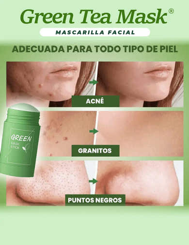 Imagen del carrusel
