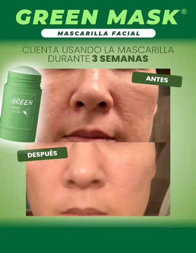 Imagen del carrusel
