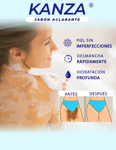 Imagen del carrusel