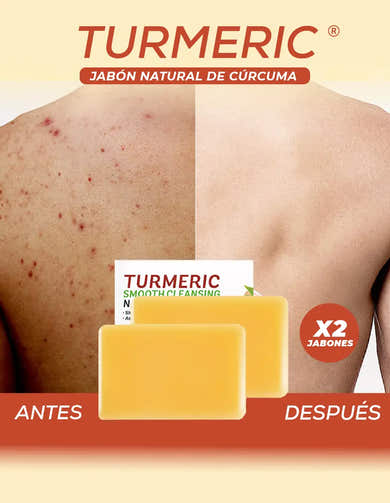 Imagen del carrusel