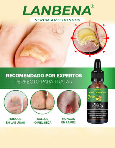 Imagen del carrusel