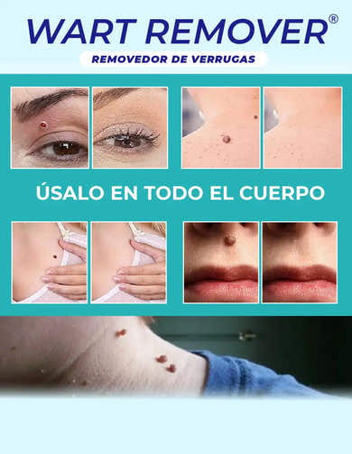 Imagen del carrusel