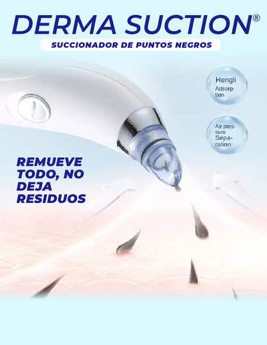Imagen del carrusel