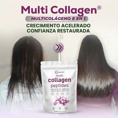 Imagen del carrusel