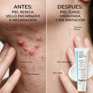 Imagen del carrusel