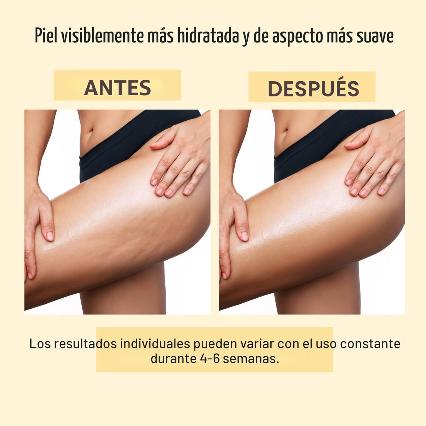 ACEITE ANTI CELULLITIS [PV1-2X1-WHATSAPP-HYPEIMPORTS]
