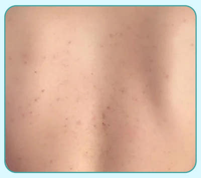 After Image