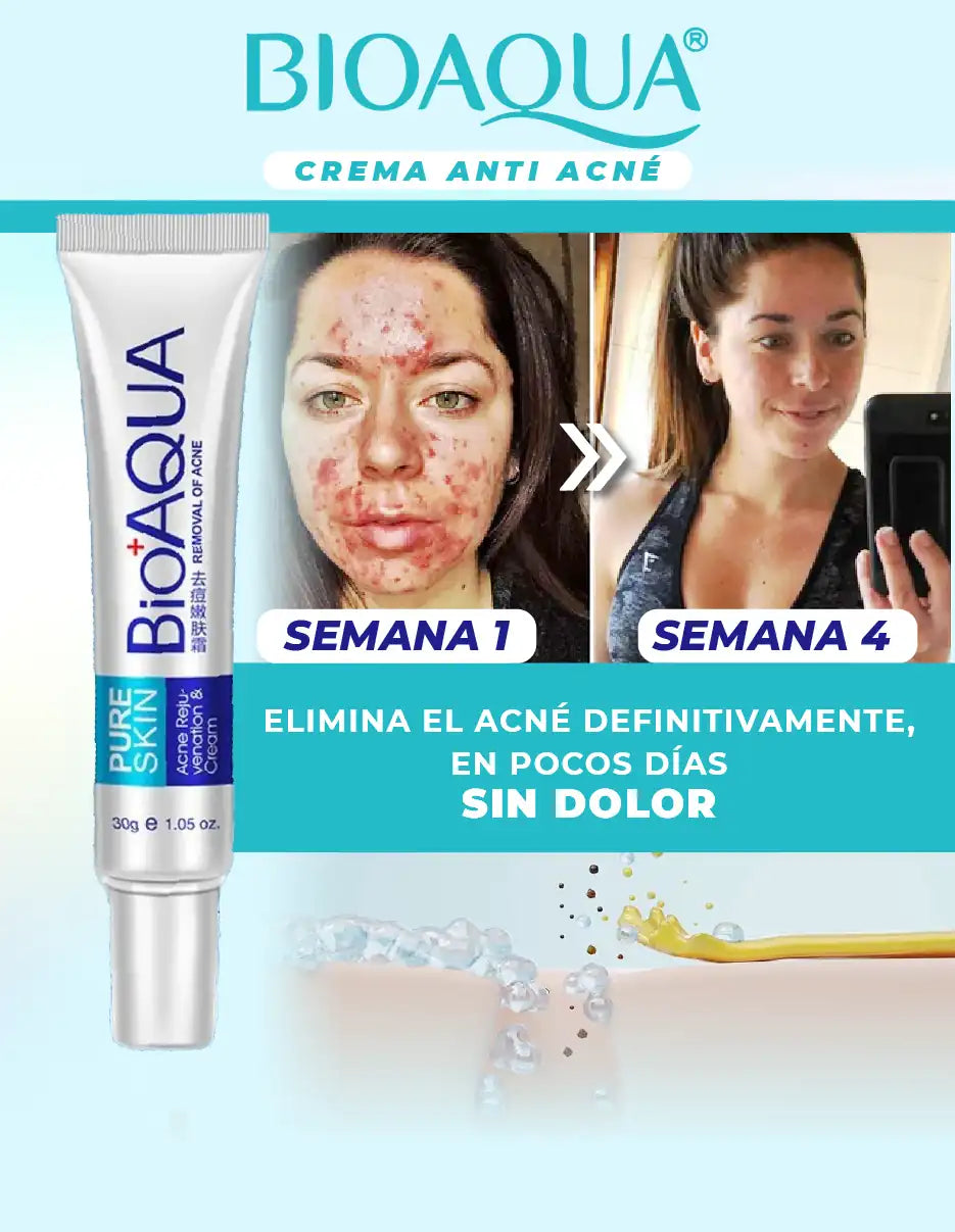 CREMA ANTI ACNE BIOAQUA [PV1-TIKTOK-HYPEIMPORTS]