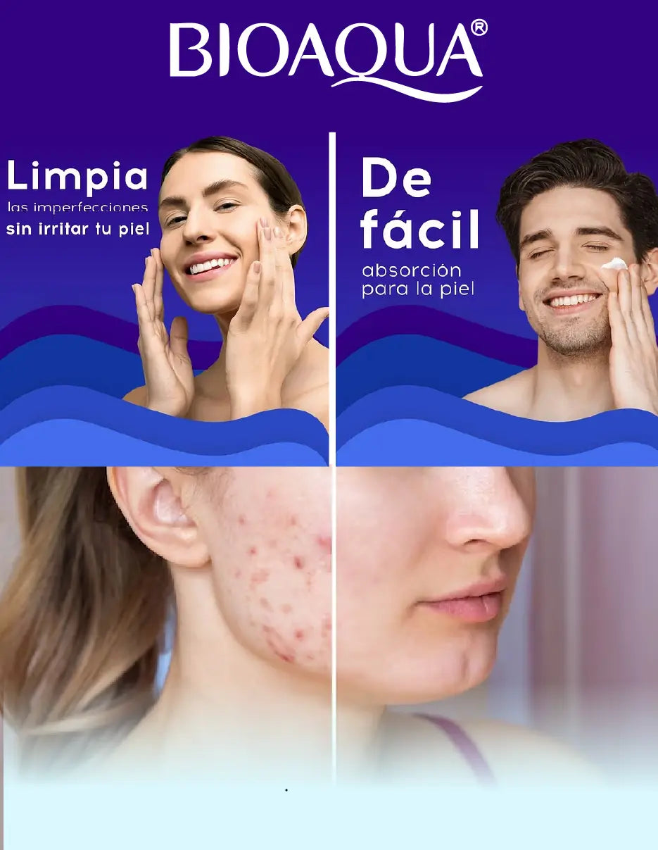 CREMA ANTI ACNE BIOAQUA [PV1-TIKTOK-HYPEIMPORTS]