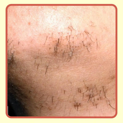 Before Image