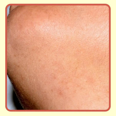 After Image
