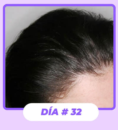 After Image