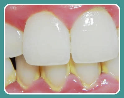 Before Image