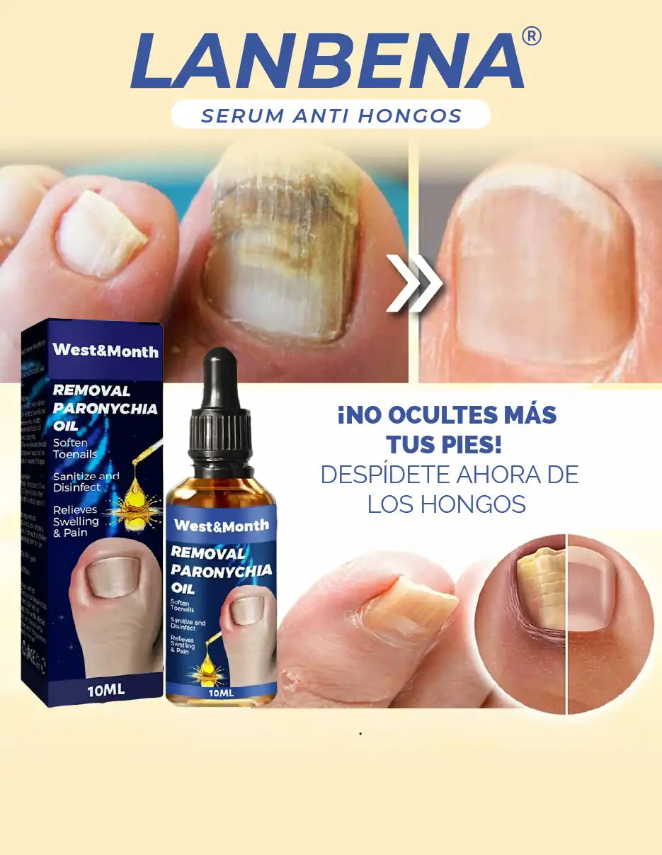 REMOVEDOR DE HONGOS LANBENA [PV1-TIKTOK-HYPEIMPORTS]