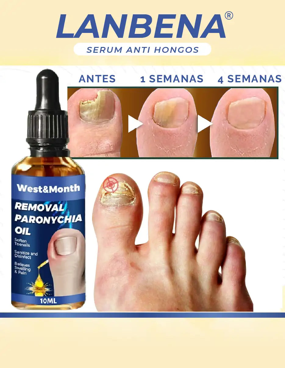 REMOVEDOR DE HONGOS LANBENA [PV1-TIKTOK-HYPEIMPORTS]