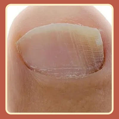 After Image