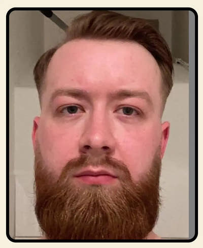 After Image