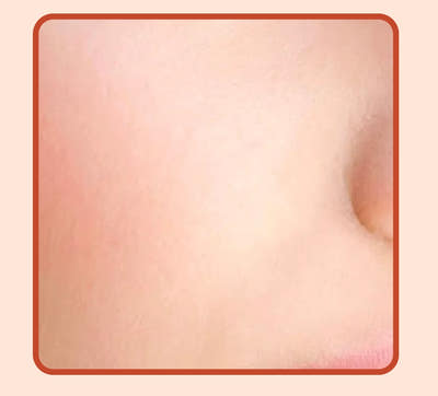 After Image