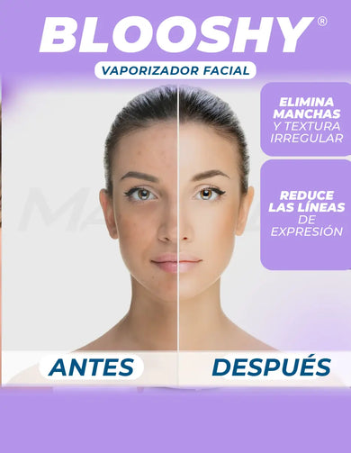 Imagen del carrusel